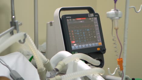 A-monitor-tracking-the-vital-signs-of-a-COVID-19-patient-sounds-a-critical-warning